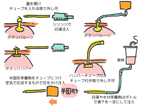 ボタンバンパー 