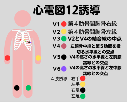 心電図12誘導